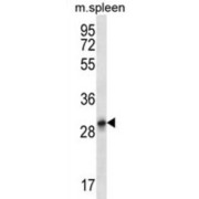 KRT222P Antibody