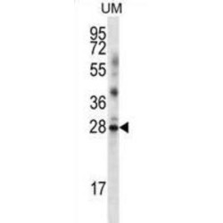 LRRN4 C-Terminal Like (LRRN4CL) Antibody