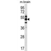 COP9 Signalosome Complex Subunit 1 (GPS1) Antibody