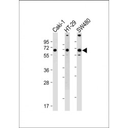 Solute Carrier Family 23 Member 1 (SLC23A1) Antibody