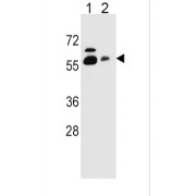 WB analysis of Lane 1: HepG2, Lane 2: NCI-H292 cell line lysates (35 µg/ml), using SLC23A1 Antibody.