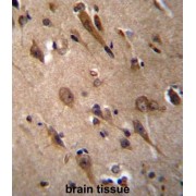 Resistant To Inhibitor of Cholinesterase 3 (RIC3) Antibody