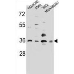 Resistant To Inhibitor of Cholinesterase 3 (RIC3) Antibody