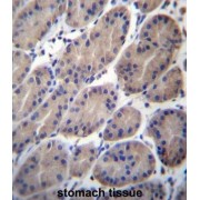 CTTNBP2 N-Terminal-Like Protein (CTTNBP2NL) Antibody