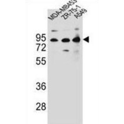 CTTNBP2 N-Terminal-Like Protein (CTTNBP2NL) Antibody