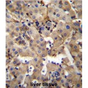 Sphingosine 1 Phosphate Lyase 1 (SGPL1) Antibody