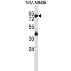 Sphingosine 1 Phosphate Lyase 1 (SGPL1) Antibody