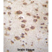 Signal-Transducing Adaptor Protein 2 (STAP2) Antibody