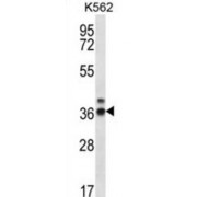 Ribonuclease P Protein Subunit p38 (RPP38) Antibody