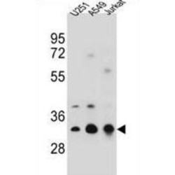 Tropomyosin Alpha-4 Chain (TPM4) Antibody