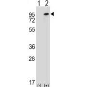 Wolf-Hirschhorn Syndrome Candidate 1-Like Protein (WHSC1L1) Antibody