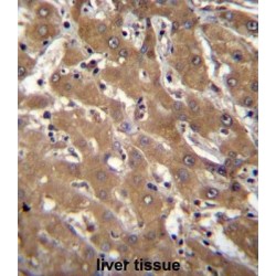 Speckle-Type POZ Protein-Like (SPOPL) Antibody