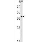 WB analysis of uterus tumor cell line lysates.