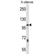 Sulfatase 2 (SULF2) Antibody