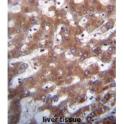 Probable tRNA Pseudouridine Synthase 1 (TRUB1) Antibody