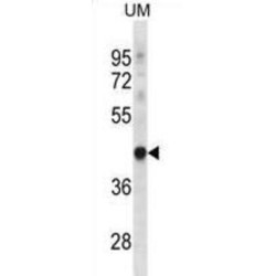 Probable tRNA Pseudouridine Synthase 1 (TRUB1) Antibody