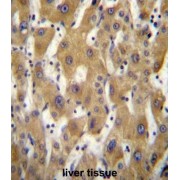 PAGE Family Member 5 (PAGE5) Antibody