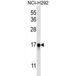 PAGE Family Member 5 (PAGE5) Antibody