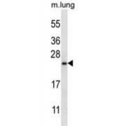 GTPase RhebL1 (RHEBL1) Antibody