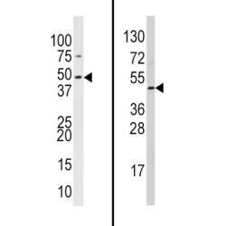 Suppressor of Variegation 3-9 Homolog 2 (SUV39H2) Antibody