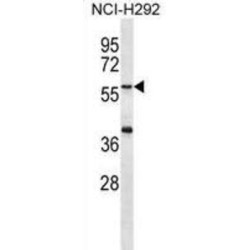 Matrilin 1 (MATN1) Antibody