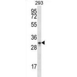 Neuronal Membrane Glycoprotein M6-A (GPM6A) Antibody