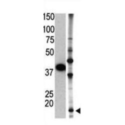 Small Ubiquitin Related Modifier Protein 2 (SUMO2) Antibody