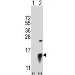 Small Ubiquitin Related Modifier Protein 2 (SUMO2) Antibody