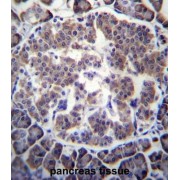 Transducin Beta Like 2 (TBL2) Antibody