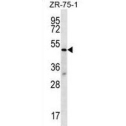 Transducin Beta Like 2 (TBL2) Antibody