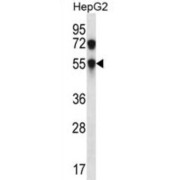 Carbohydrate Sulfotransferase 8 (CHST8) Antibody