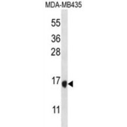 Tachykinin-4 (TAC4) Antibody