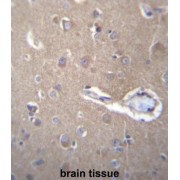 Translocation Protein SEC62 (SEC62) Antibody