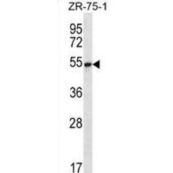 Translocation Protein SEC62 (SEC62) Antibody