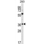 Neuroplastin (NPTN) Antibody