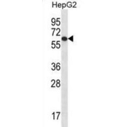 TBC1 Domain Family Member 22A (TBC1D22A) Antibody