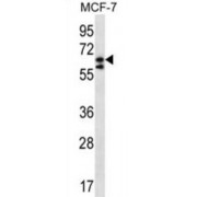 Pogo Transposable Element With KRAB Domain (POGK) Antibody