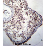 Glucocorticoid-Induced Transcript 1 Protein (GLCCI1) Antibody