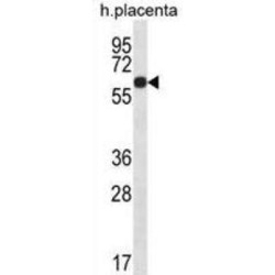 Glucocorticoid-Induced Transcript 1 Protein (GLCCI1) Antibody