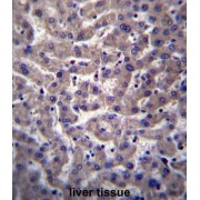 Prostaglandin Reductase 2 (PTGR2) Antibody