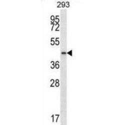 Prostaglandin Reductase 2 (PTGR2) Antibody