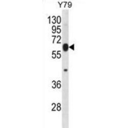 E3 Ubiquitin-Protein Ligase RNF180 (RNF180) Antibody