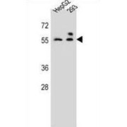 ZFP91 Zinc Finger Protein (ZFP91) Antibody