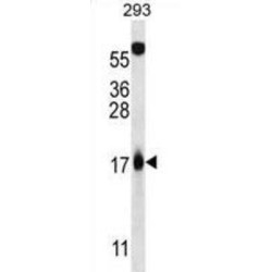 Tumor Suppressor ARF (MLM) Antibody