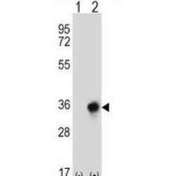 Carbonyl Reductase 3 (CBR3) Antibody