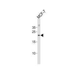 O-6-Methylguanine DNA Methyltransferase (MGMT) Antibody