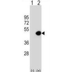 Dynactin Subunit 2 (DCTN2) Antibody