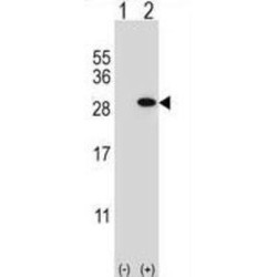 Glutathione S Transferase Theta 1 (GSTT1) Antibody