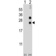 Western blot analysis of 293 cell lysates (2 µg/lane) non-transfected (Lane 1) or transfected (Lane 2) with the CSN1S1 gene using Alpha-S1-Casein (CSN1S1) Antibody.