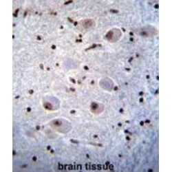 Paired Box Protein Pax-6 (PAX6) Antibody